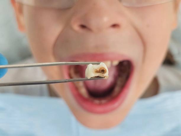 Best Emergency Dental Services for Seniors in Williamston, NC